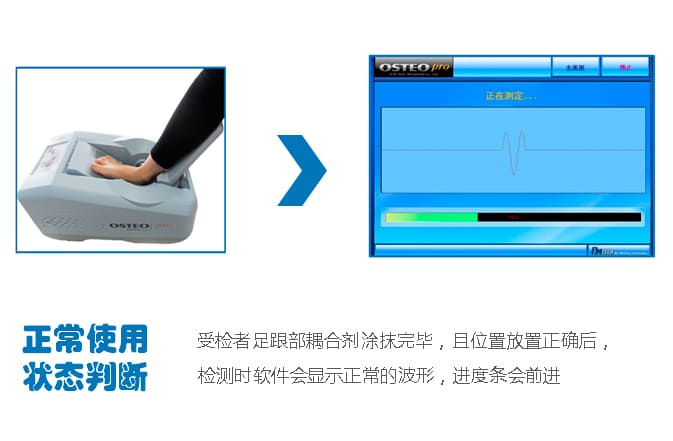 骨密度仪正常判断_骨密度测定